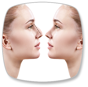 Revision Nose Aesthetics (Revision Rhinoplasty)