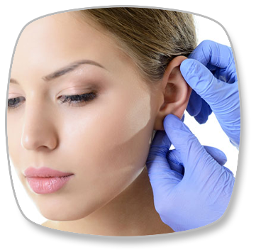 Otoplasty (Prominent Ear Surgery)