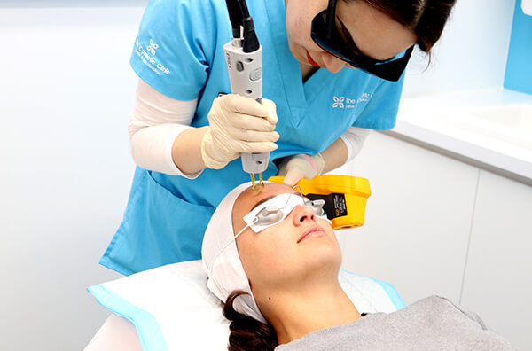 LASER REJUVENATION