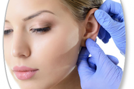 Otoplasty (Prominent Ear Surgery)