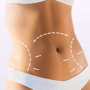 Tummy Tuck